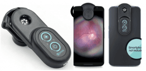 Wow, Ternyata Kamera Smartphone Anda Bisa Digunakan untuk Diagnosis Penyakit!