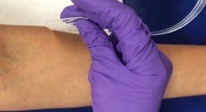 Graphene Electronic Tattoo (GET) : E-Tato Untuk Memonitor Kesehatan Manusia