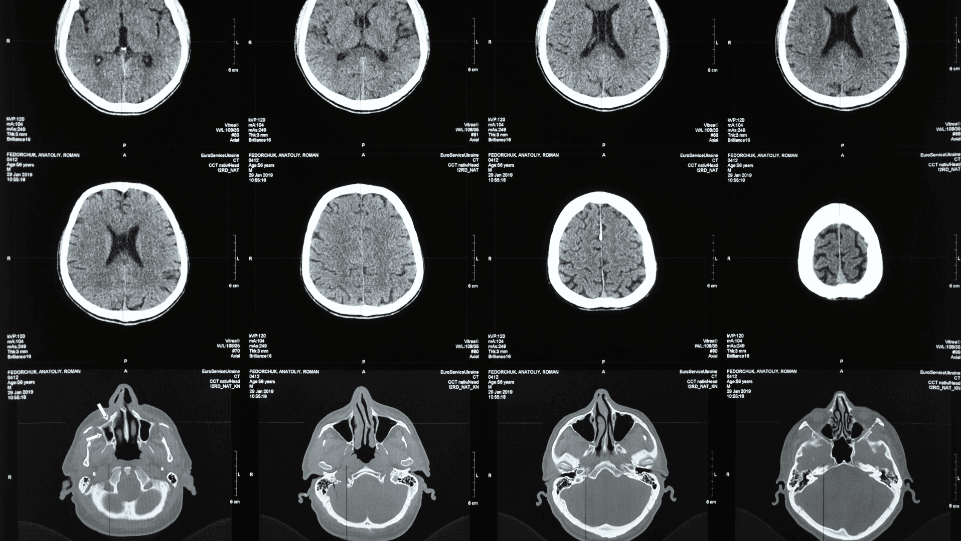 Penerapan kecerdasan buatan dalam radiologi