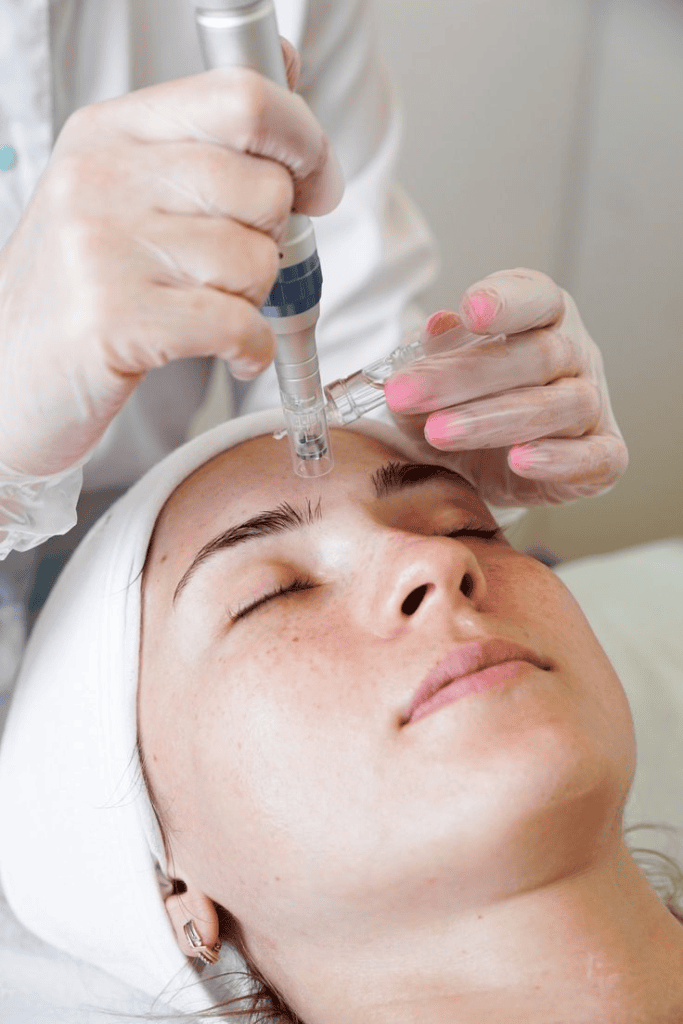 teknologi microneedle dalam kecantikan