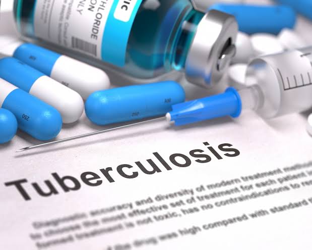 Tuberculosis