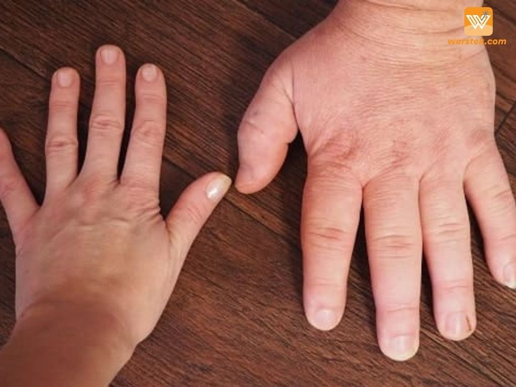 gigantisme
